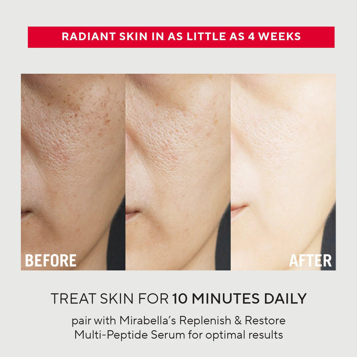 Mirabella Phototherapy 7-Color LED Facial Mask with Near Infrared