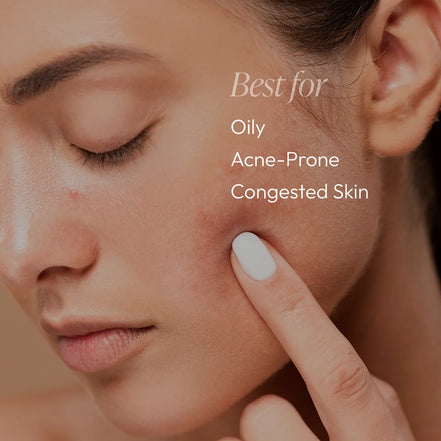 Circadia Acne Essentials Regimen Kit